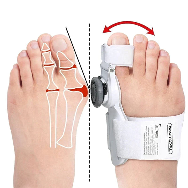 ToeAligner™ Universal Corrector for Hallux Valgus