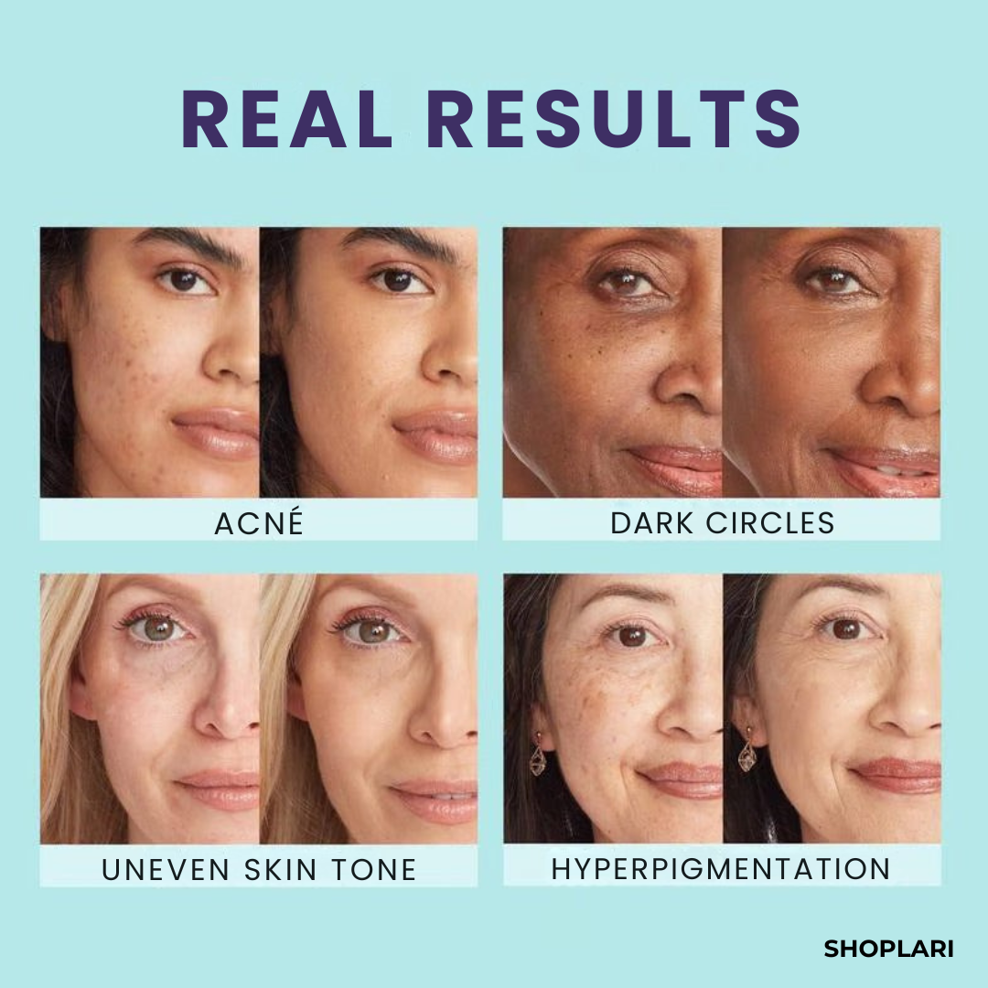 Last Day 50% OFF🔥 | GlowMist™ All-in-One Skin Perfector