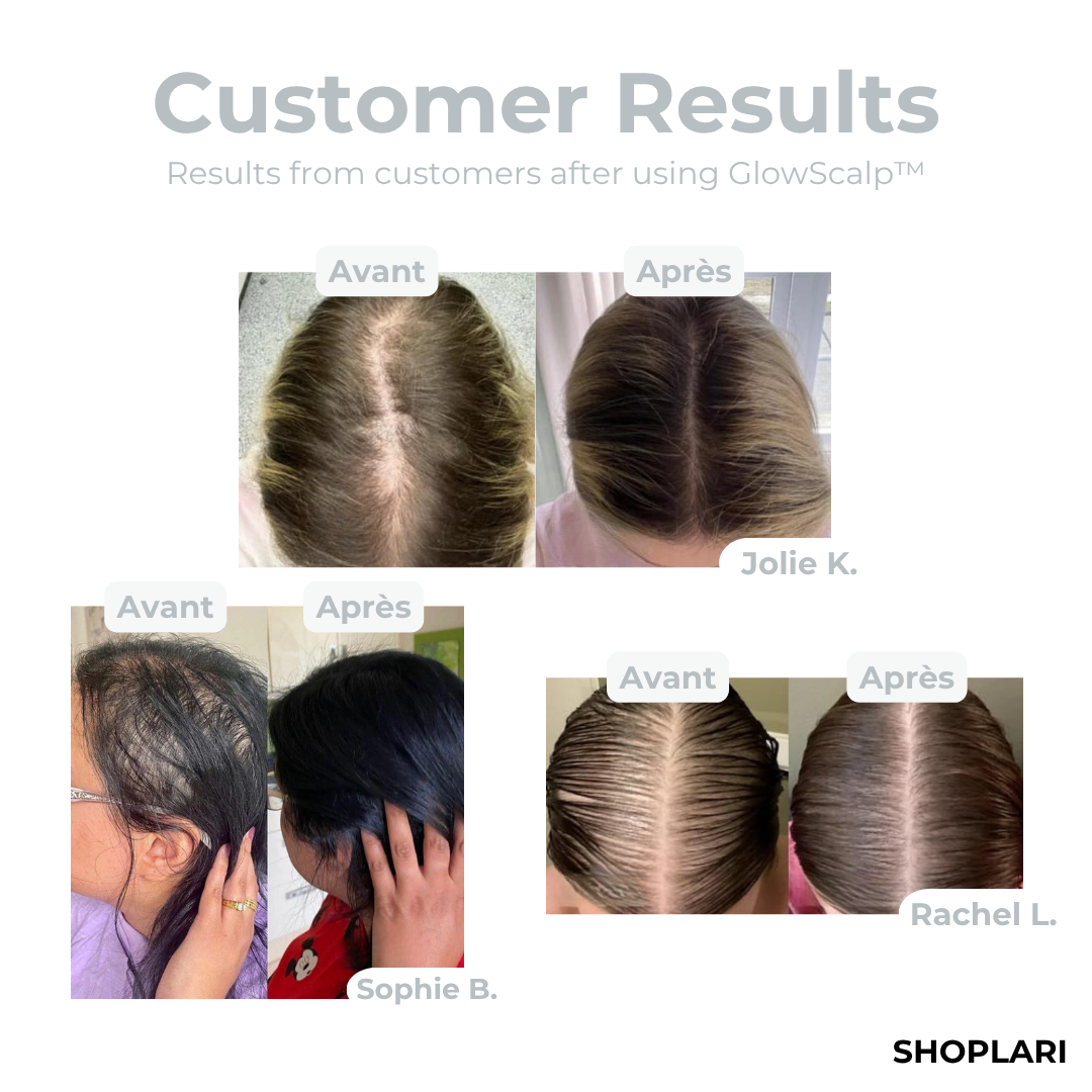 Last Day 50% OFF | GlowScalp™ Head Massager Brush