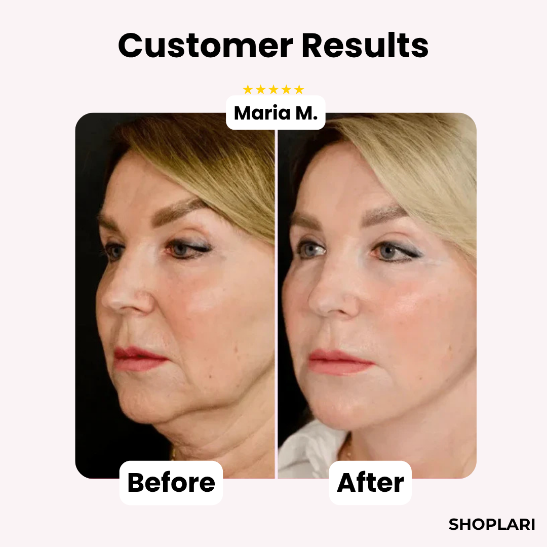 Last Day 50% OFF🔥 |  GlowLift™ Invisible Face Lift Tape (40 pcs)