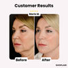 Last Day 50% OFF🔥 |  GlowLift™ Invisible Face Lift Tape (40 pcs)