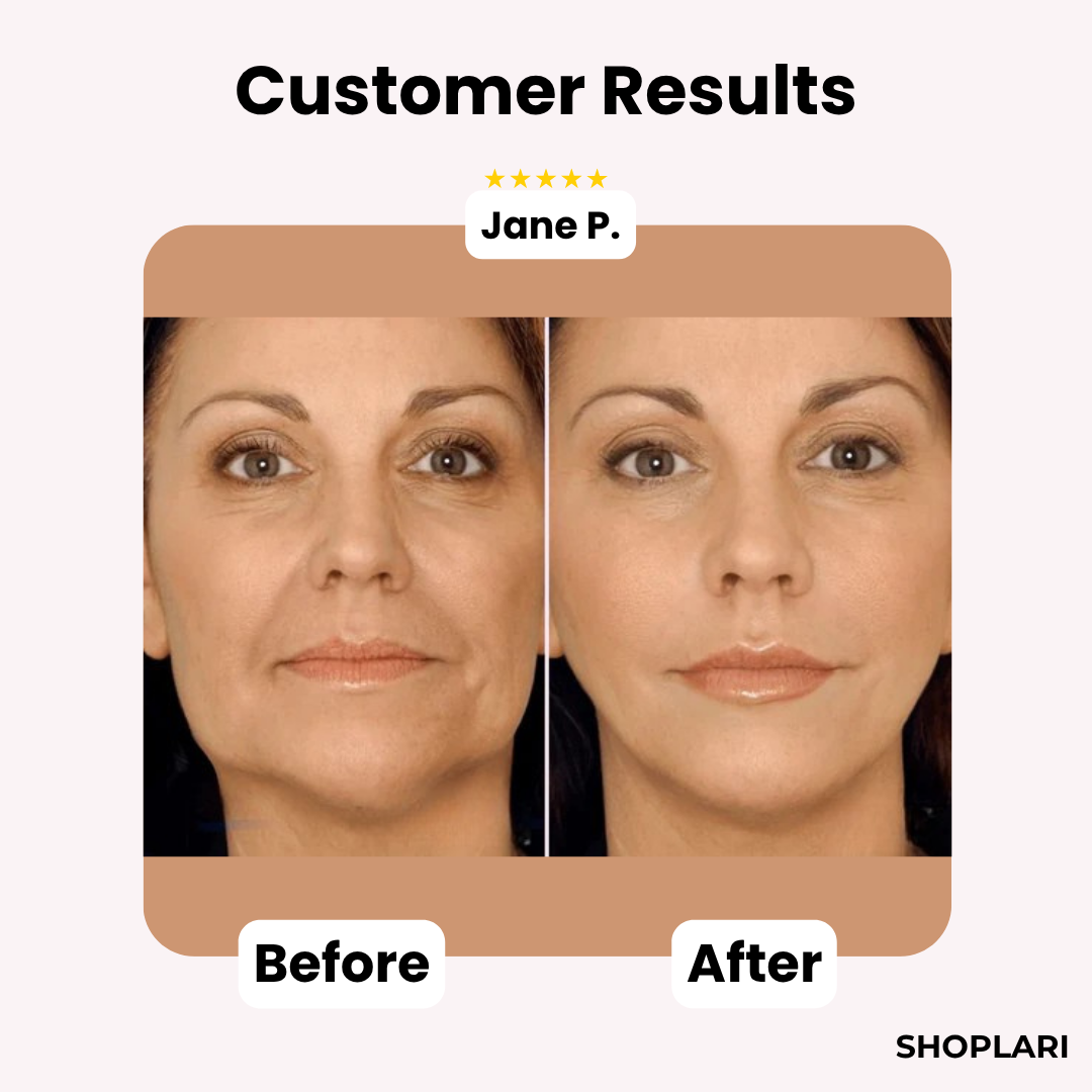 Last Day 50% OFF🔥 |  GlowLift™ Invisible Face Lift Tape (40 pcs)