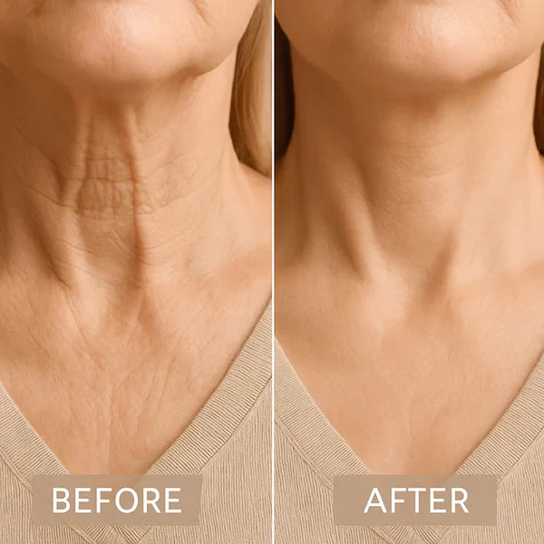 VelvaLift™ Face Neck Lifting Tape