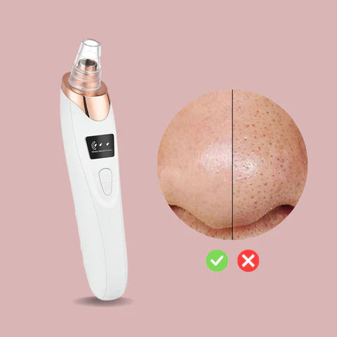 Last Day 50% OFF | PoreGlow™ Blackhead Remover