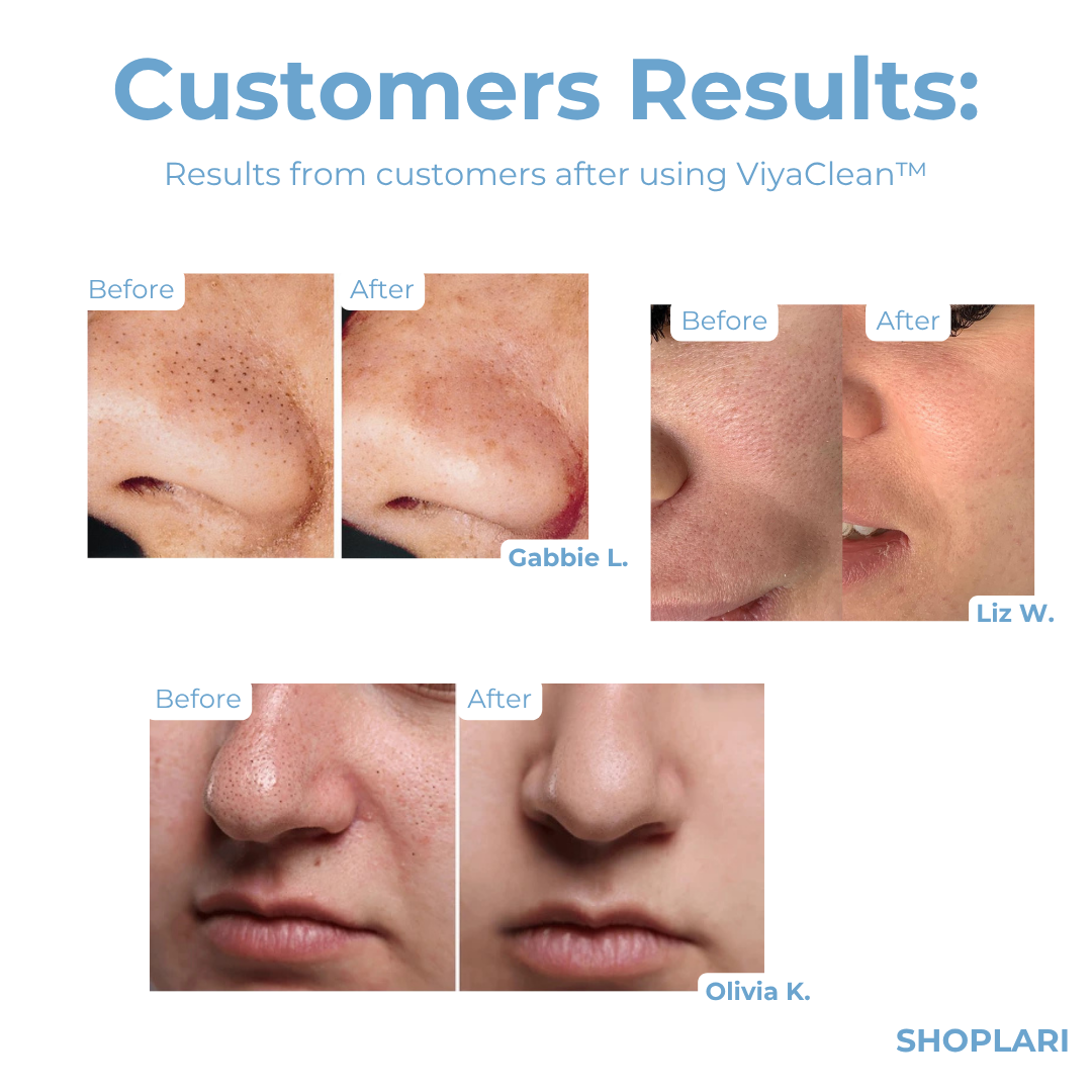 Last Day 5+5 FREE | ViyaClean™ Pore Cleansing Serum