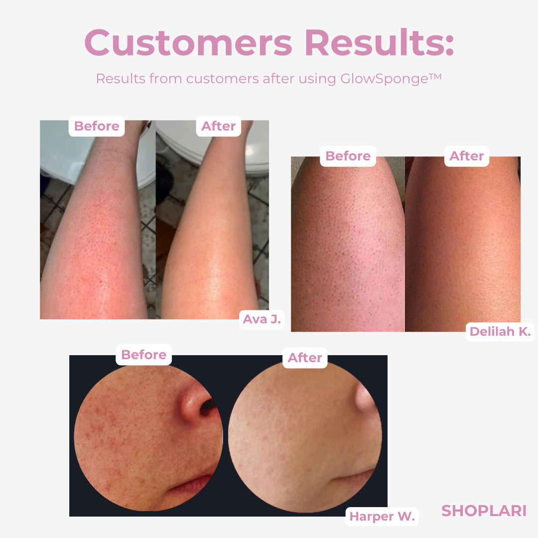 1+2 FREE🔥 I GlowSponge™ Body Scrub Sponge