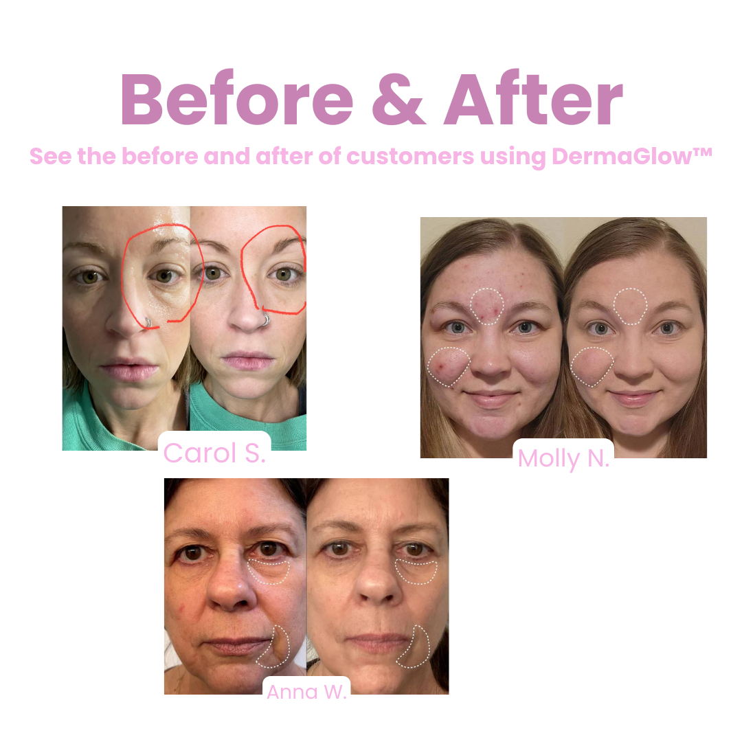 DermaGlow™ Remove fine lines and wrinkles effortlessly