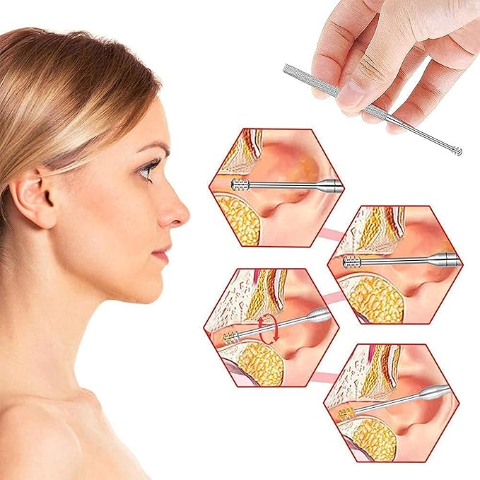 FreshClean™ Ear Cleaning Kit
