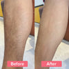 SilkySmooth™ | Hair Remover