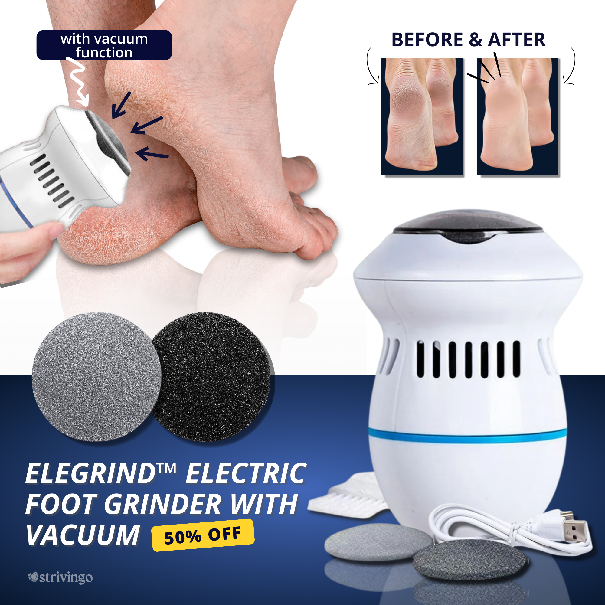 Elegrind™ Electric Foot Grinder with Vacuum | incl. 2 Grinder Heads