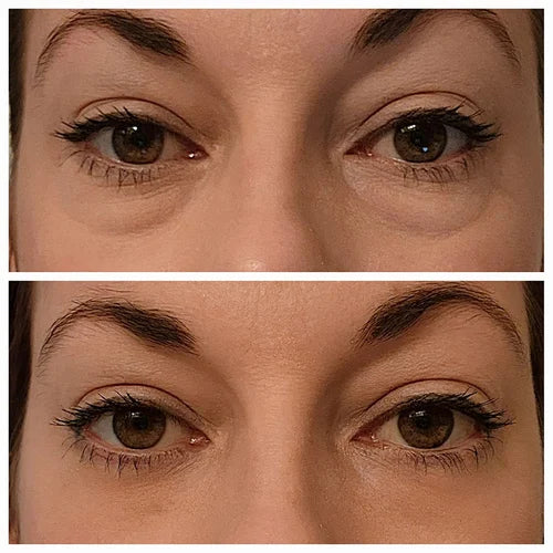 InstaLift™ Instant Firming Eye Tightener