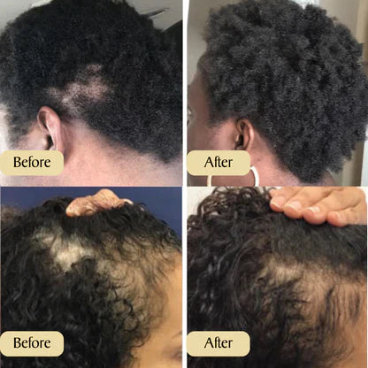 1+1 FREE I HairRevive™ Your Natural Oil Treatment for Hair Growth