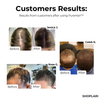 1+1 FREE🔥 I PureHair™ Natural Hair Growth Oil