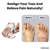 Last Day 50% OFF | ToeAlign™ Corrector for Hallux Valgus